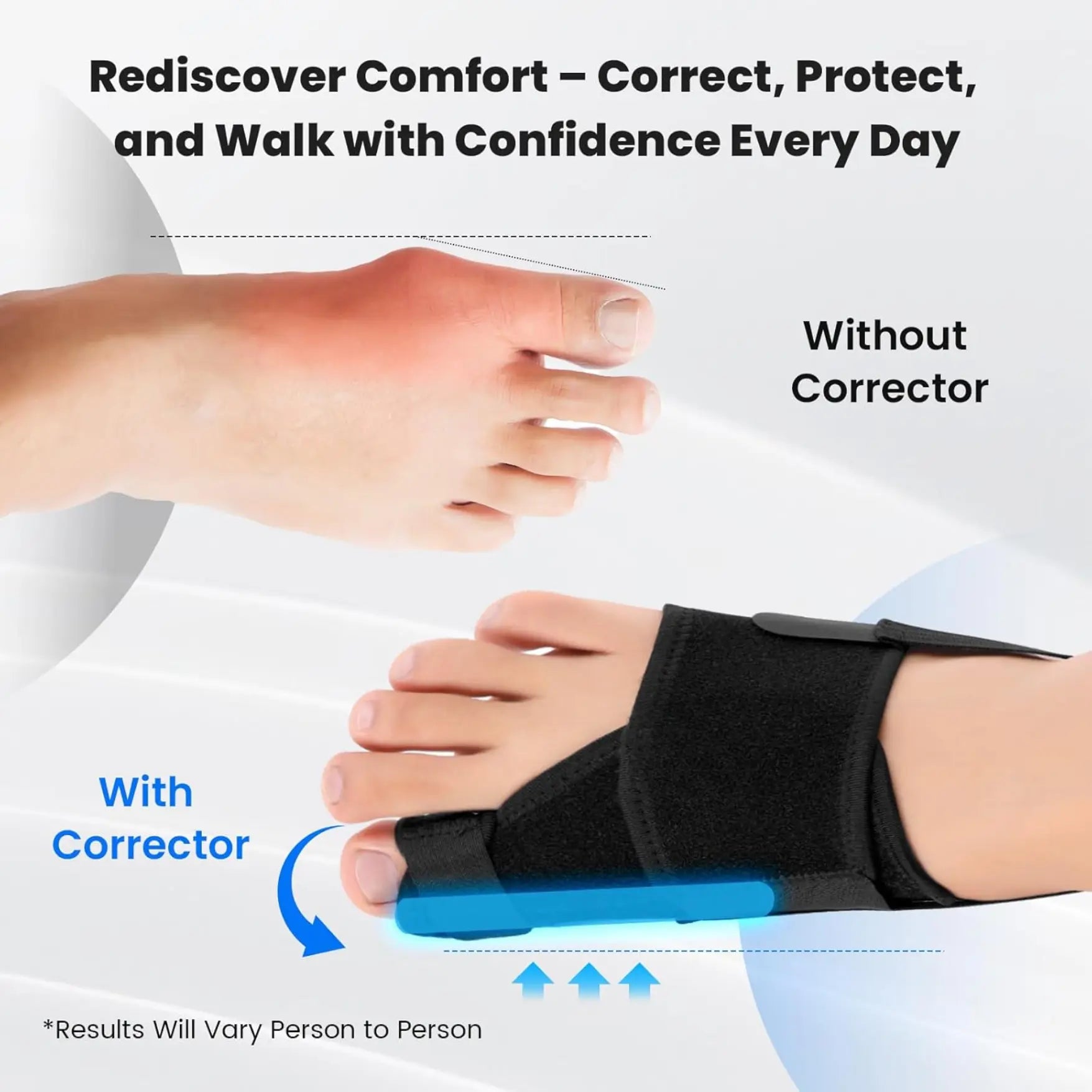 Slumblr® Bunion Corrector for Big Toe Straightener (2pcs) Slumblr