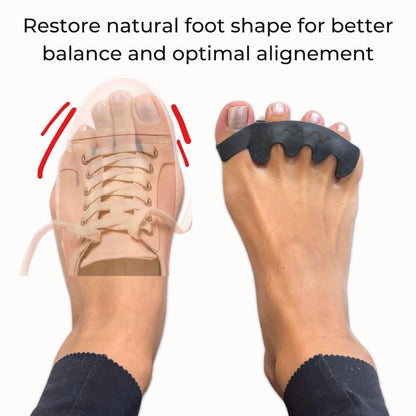 Slumblr® Silicone Alignment Spacer Set