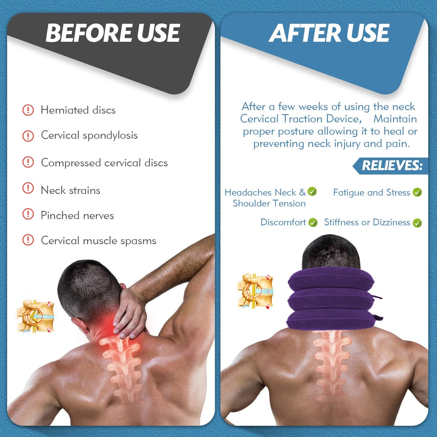 Slumblr® Traction Stretcher Device Inflatable