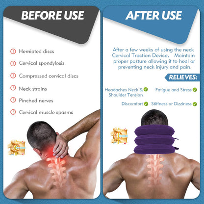 Slumblr® Traction Stretcher Device Inflatable